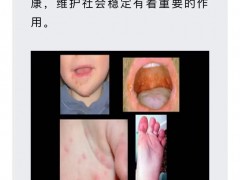 手足口病预防小常识