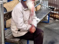 七旬亚裔老者刚来美国两周 被陌生人打得满脸血送医