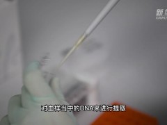 能“剧透”癌症的基因检测，一定要做吗？