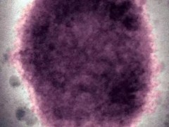 中国生物：消灭天花后，“牛痘”安全封存以备不时之需