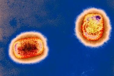 彩色透射电子显微捕获的猴痘病毒颗粒。英国《新科学家》杂志网站 图