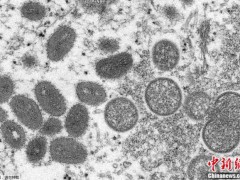 世卫组织：全球已有50个国家和地区确诊3400多例猴痘病例