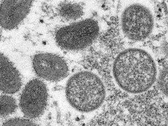 世卫组织：全球已报告近1.4万例猴痘确诊病例，5人死亡