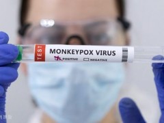 美国两名儿童感染猴痘病毒 系家庭传播